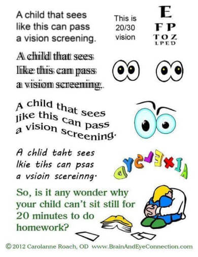 vision eye test